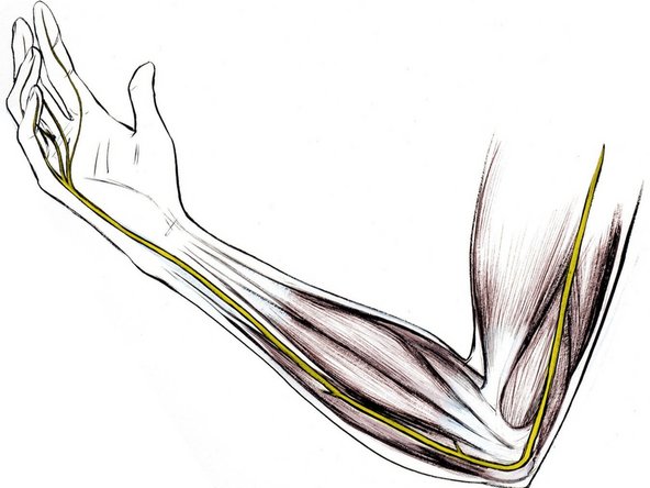 Backyard Brain's Human-Human Interface Assembly: passo 6, immagine 3 di 3